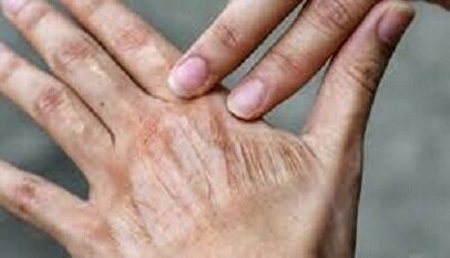تأثیر عجیب آلودگی هوا بر پیری پوست