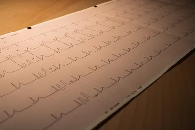 همه-آنچه-باید-از-سندرم-مرگ-ناگهانی-بزرگسالان-بدانید